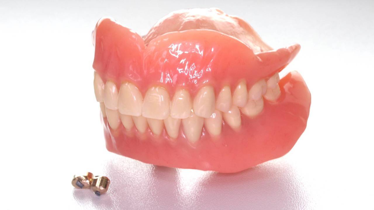 日本で数少ない ドイツ式テレスコープ義歯を製作